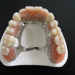 CrCo Denture