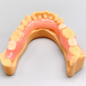 Flexible Denture