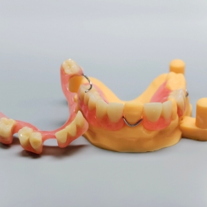 CrCo Denture