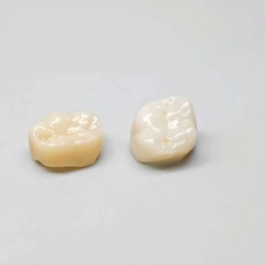 Zirconia Crown