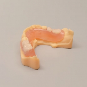 Valplast Denture