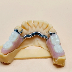 CrCo Denture