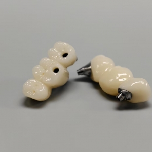 Implant