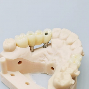 Implant